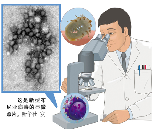 新型布尼亚病毒